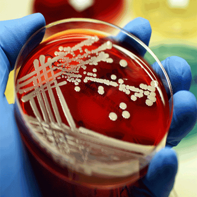 Número de bacterias aeróbicas (número de bacterias mesófilas aeróbicas, número de colonias aeróbicas)