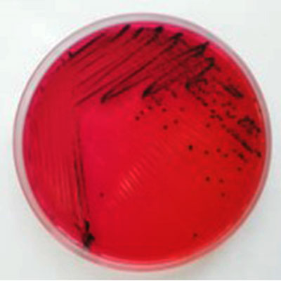 Alicyclobacillus spp. تقرير