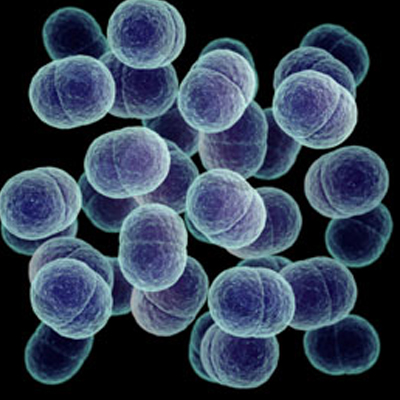 Determination of Anaerobic Bacteria Count