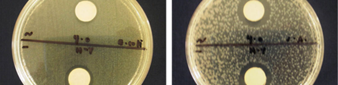 Determination of Anti Bacterial Activity