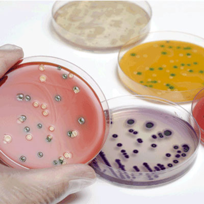 Cultura bacteriana