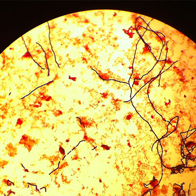 Bestimmung von Clostridium perfringens