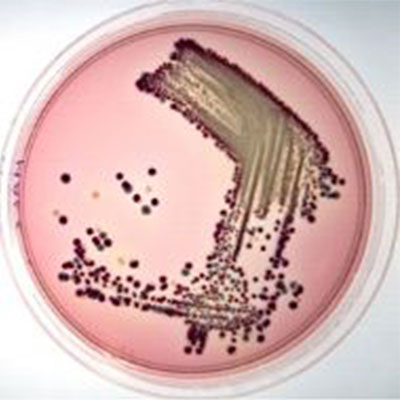 E. coli O157: espèce bactérienne H7, gram négatif, anaérobie facultative, 37 et pH 7,2 au niveau de croissance optimal, est une bactérie mobile et résistante à la chaleur. Deux méthodes d'analyse différentes sont utilisées pour déterminer l'espèce O157: H7 de la bactérie Escherichia coli. Un groupe d’analyses sont des méthodes classiques d’analyse. Un groupe d'analyses sont des méthodes rapides. Les méthodes d'analyse classiques sont réalisées par enrichissement sélectif et ensemencement sur des milieux solides. Selon les principes du Turkish Food Codex, la présence de bactéries E. coli O157: H7 dans les aliments est étudiée dans un échantillon de gramme 25. Les échantillons de test sont prélevés dans des conditions d'asepsie et la chaîne du froid est protégée et transmise au laboratoire. E. coli O157: Des kits de tests immunologiques préparés avec le principe de flux immunitaire sont utilisés pour les tests rapides d’analyses H7. La suspension de la colonie dans la culture du milieu d'enrichissement sélectif dans de l'eau est maintenue dans de l'eau bouillante pendant environ 15 minutes, puis ramenée à température ambiante. Ensuite, une certaine quantité de cette suspension est introduite dans le kit et placée à température ambiante pendant quelques minutes 20. Une bande rouge devrait apparaître sur le kit pendant ce temps. Cette bande rouge indique la présence de E. coli O157: H7 dans l'échantillon testé. Ces kits sont appelés kits rapides car ils donnent les résultats environ une demi-heure après l'étape de pré-enrichissement. Toutefois, le résultat positif obtenu avec ce kit concerne uniquement Escherichia coli O157: H7. Un antisérum H7 est également nécessaire pour confirmer cette espèce bactérienne. Dans des laboratoires avancés, des tests rapides de détermination de E. coli O157: H7 sont effectués dans le cadre d'analyses microbiologiques. Au cours de ces études, les normes et méthodes d'analyse nationales et étrangères sont prises comme base. La norme prise en compte à cet égard est la suivante: • TS EN ISO 16654 Microbiologie des aliments pour animaux et des denrées alimentaires - méthode horizontale de détection de Eschericha coli O157