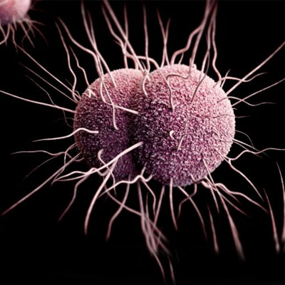 Determination of Enterobacter Sakazakii (Cronobacter spp.)