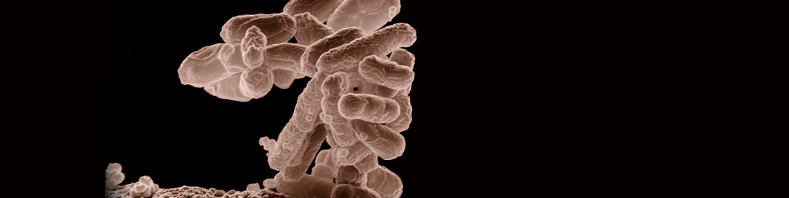 Coliform, Fecal Coliform, E. coli განსაზღვრა (EMS) (FDA BAM)