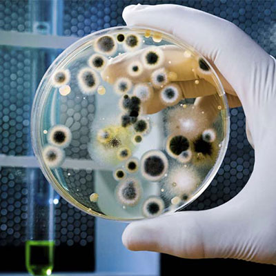 Coliform განსაზღვრა (მყარი მედია)