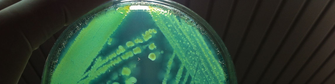 Mold and Yeast Count (Rapid Test)