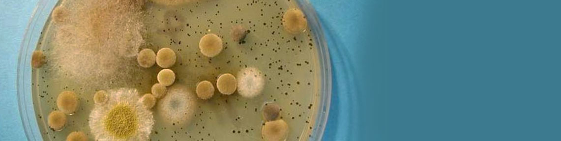 Mold and Yeast Count