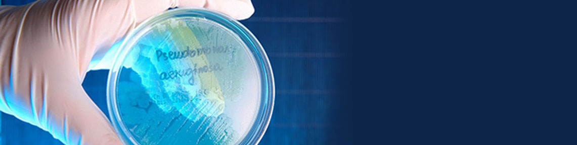 Determination of the number of lipolytic bacteria