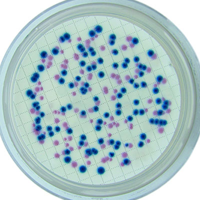 Вызов Listeria Monocytogenes (быстрый тест)