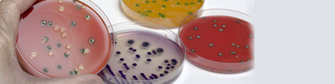 Προσδιορισμός της Listeria Monocytogenes