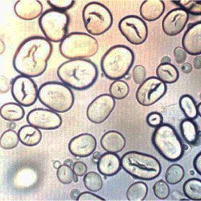Nişasta Granüllerinin Mikroskobik Görünüşü