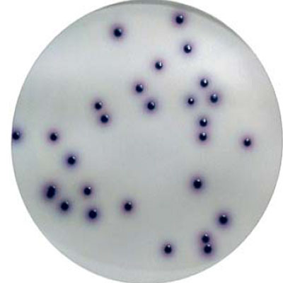 Determination of Osmophilic Yeast