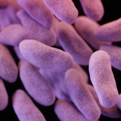 Determination of Proteolytic Bacteria Count