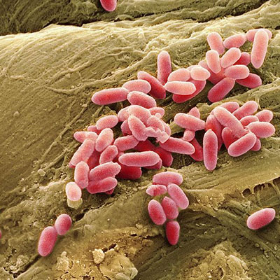 Determinação de Pseudomonas Aeruginosa