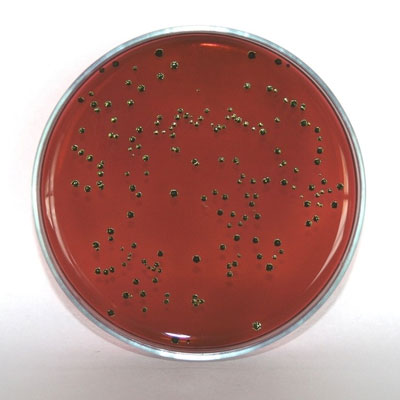 Pseudomonas spp. تقرير