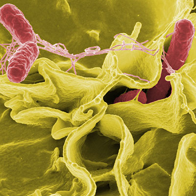 Análise de Sorotipagem Salmonella Enterica