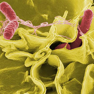 Salmonella Enterica-Serotypisierungsanalyse