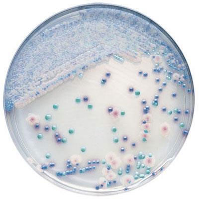 Determinación de anaerobios reductores de sulfito