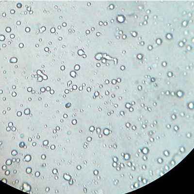 Количество соматических клеток (микроскопическое)
