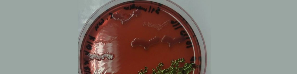 Staphylokokken-Enterotoxin-Analyse (Einzelanalyse)