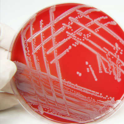 Análise de enterotoxina estafilocócica (análise única)