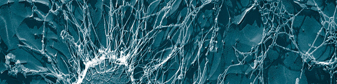 Determinação de Staphylococcus Aureus (Staphylococ coagulase positiva)