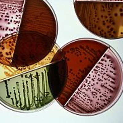 Staphylococcus Aureus Count (Schnelltest) (Coagulase-positiver Staphylococ)