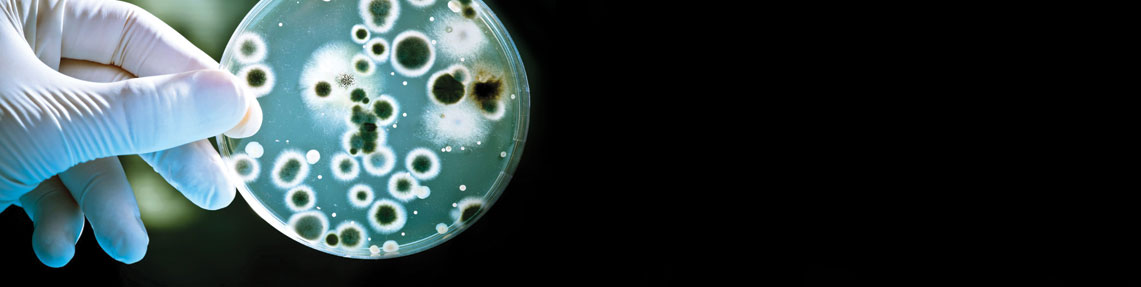 Total Yeast and Mold Count