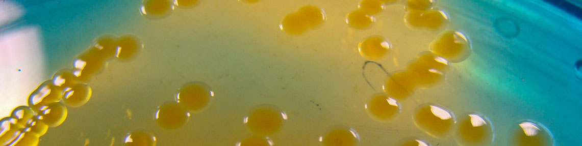 Determinação de Cholerae Vibrio