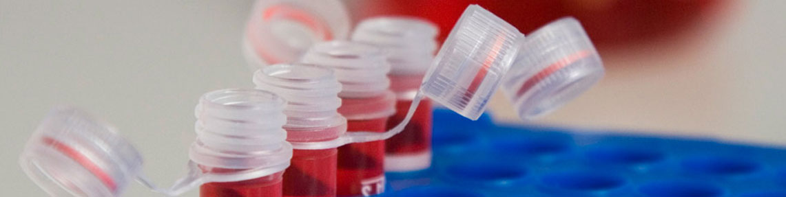 Vibrio Parahaemolyticus (Hızlı Test)