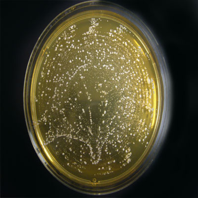 Contagem de bactérias anaeróbias