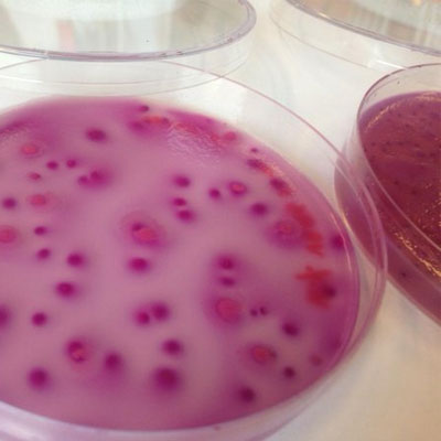 Bestimmung von Bacillus cereus