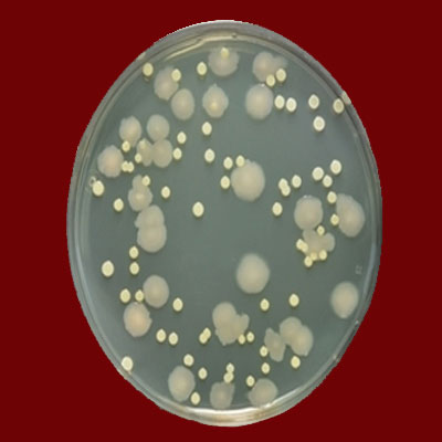 Pseudomonas Sp. подсчитывать