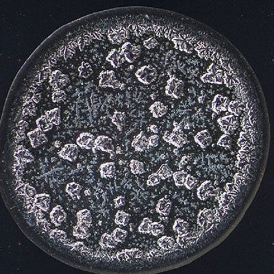 Üre Tayini (Mikroskobik)