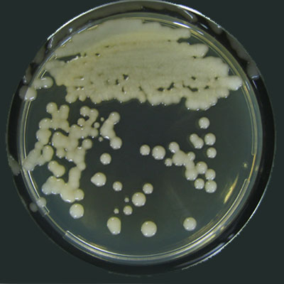 ზარის Staphylococcus Aureus