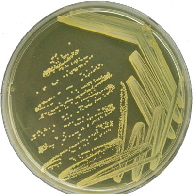 Staphylococcus sp. contar