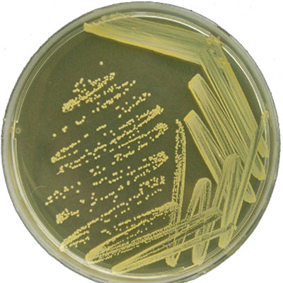 Staphylococcus Sp. Sayımı