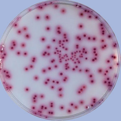 Gesamtzahl der aeroben mesophilen Bakterien